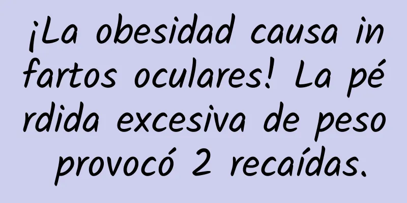 ¡La obesidad causa infartos oculares! La pérdida excesiva de peso provocó 2 recaídas.