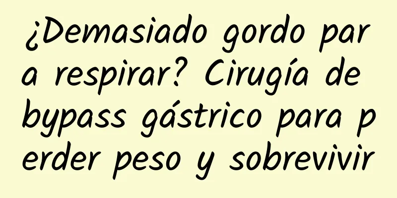 ¿Demasiado gordo para respirar? Cirugía de bypass gástrico para perder peso y sobrevivir