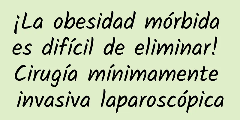¡La obesidad mórbida es difícil de eliminar! Cirugía mínimamente invasiva laparoscópica