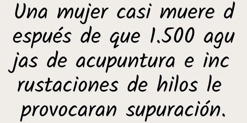 Una mujer casi muere después de que 1.500 agujas de acupuntura e incrustaciones de hilos le provocaran supuración.