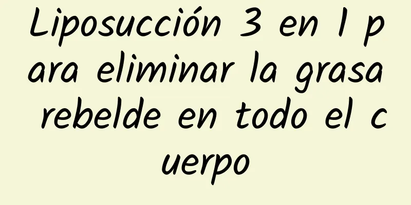 Liposucción 3 en 1 para eliminar la grasa rebelde en todo el cuerpo
