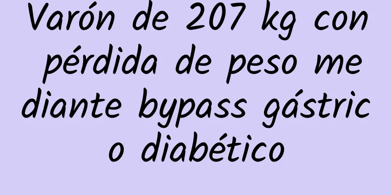 Varón de 207 kg con pérdida de peso mediante bypass gástrico diabético