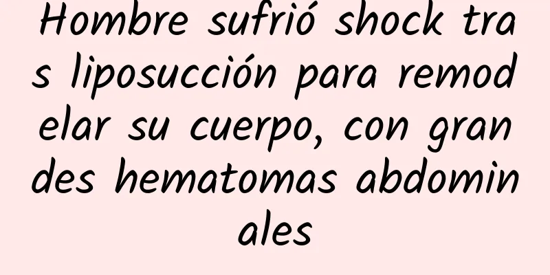 Hombre sufrió shock tras liposucción para remodelar su cuerpo, con grandes hematomas abdominales