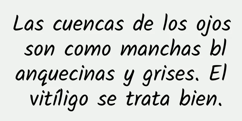 Las cuencas de los ojos son como manchas blanquecinas y grises. El vitíligo se trata bien.